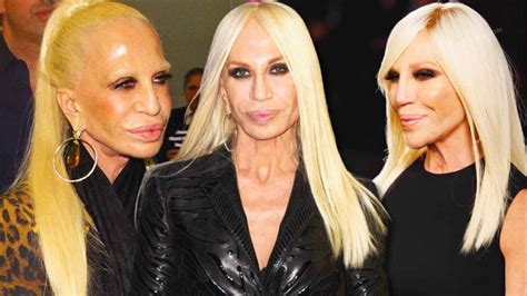 la nuova donatella versace ultima sfilate|donatella versace face what happened.